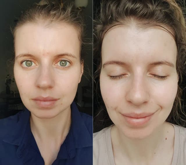 Jak mieć ładną cerę bez makijażu – proste sposoby na zdrową skórę