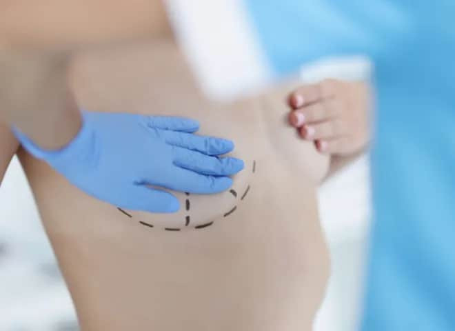 Ile kosztuje powiększenie biustu tłuszczem? Zaskakujące ceny w Polsce