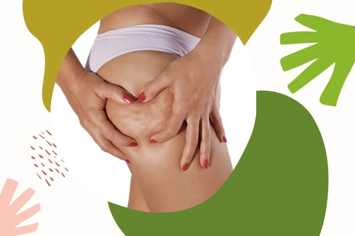 Jak rozpoznać cellulit wodny a tłuszczowy – kluczowe różnice i objawy