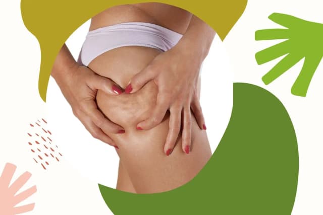 Jak rozpoznać cellulit wodny a tłuszczowy – kluczowe różnice i objawy